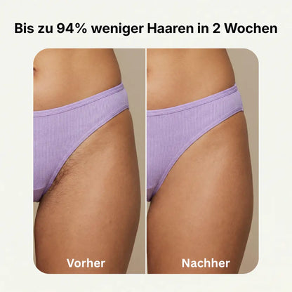 Klaréa™ Studio – IPL Haarentfernungsgerät für Zuhause